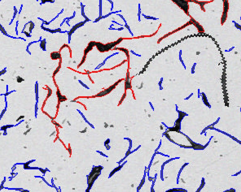 Flake size in gray cast iron Clemex