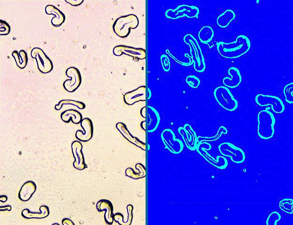 Morphology characterization of cotton fibers | Clemex