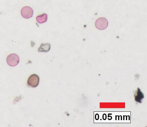 Analyse de la densité du pollen | Clemex